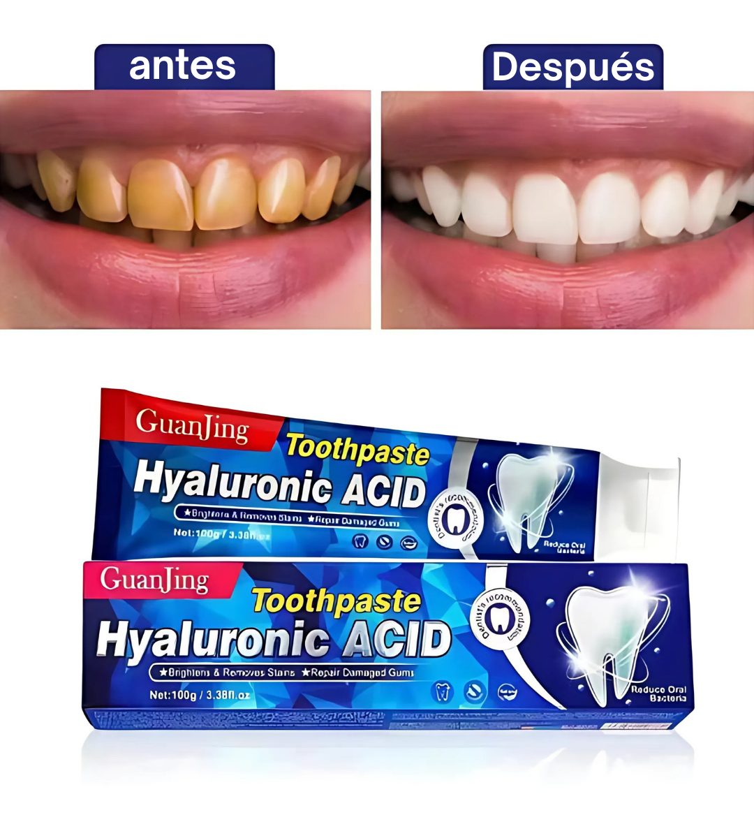 Blanqueador dental UV + Blanqueador con ácido hialurónico