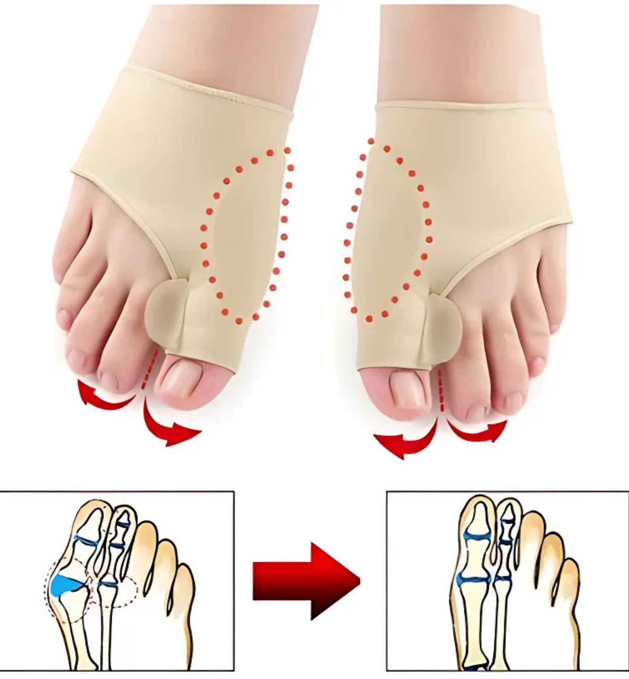 Taloneras ortopédicas + Corrector de Juanetes pack 2 uds