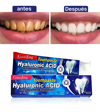 Blanqueador dental UV + Blanqueador con ácido hialurónico